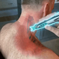 Muscle Massage Therapy Akupunkturpunkt Penna