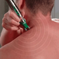 Muscle Massage Therapy Akupunkturpunkt Penna